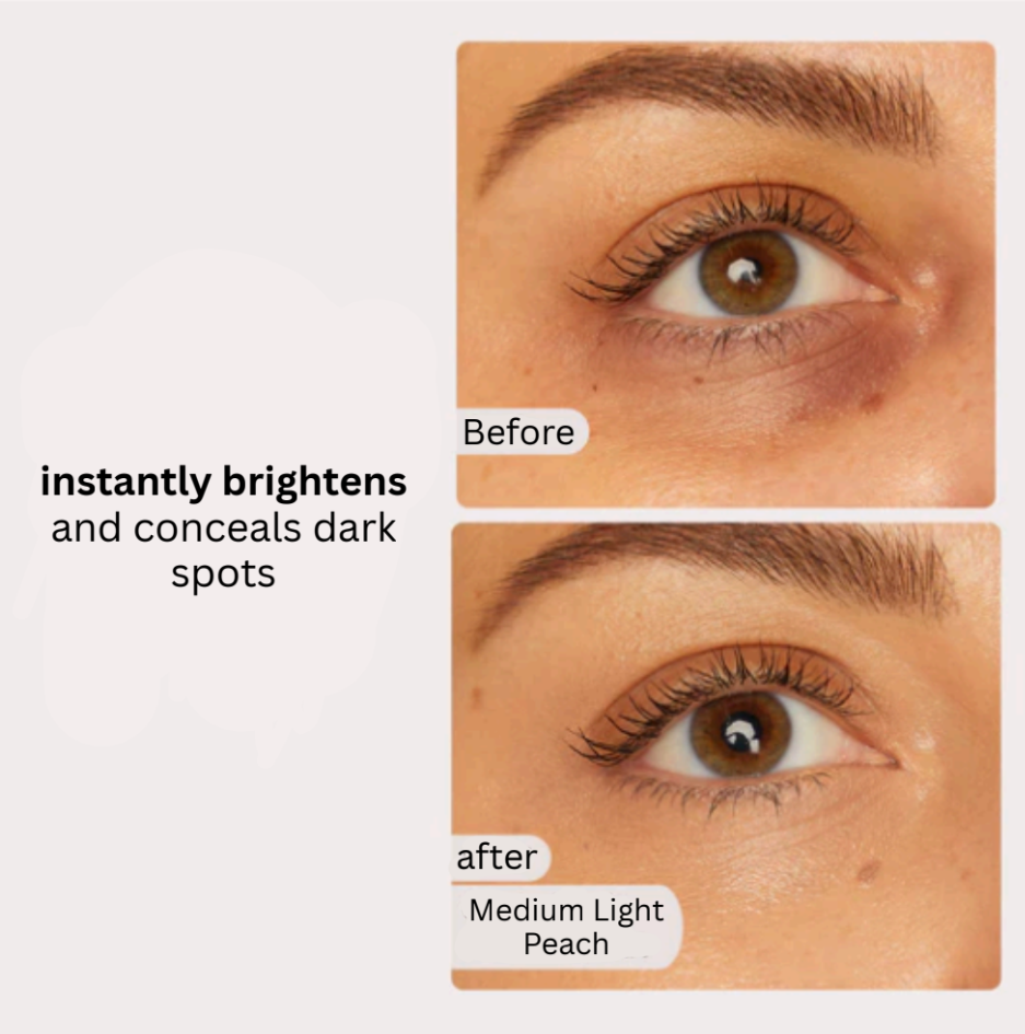 Glowvéa Radiant Under Eye Corrector™