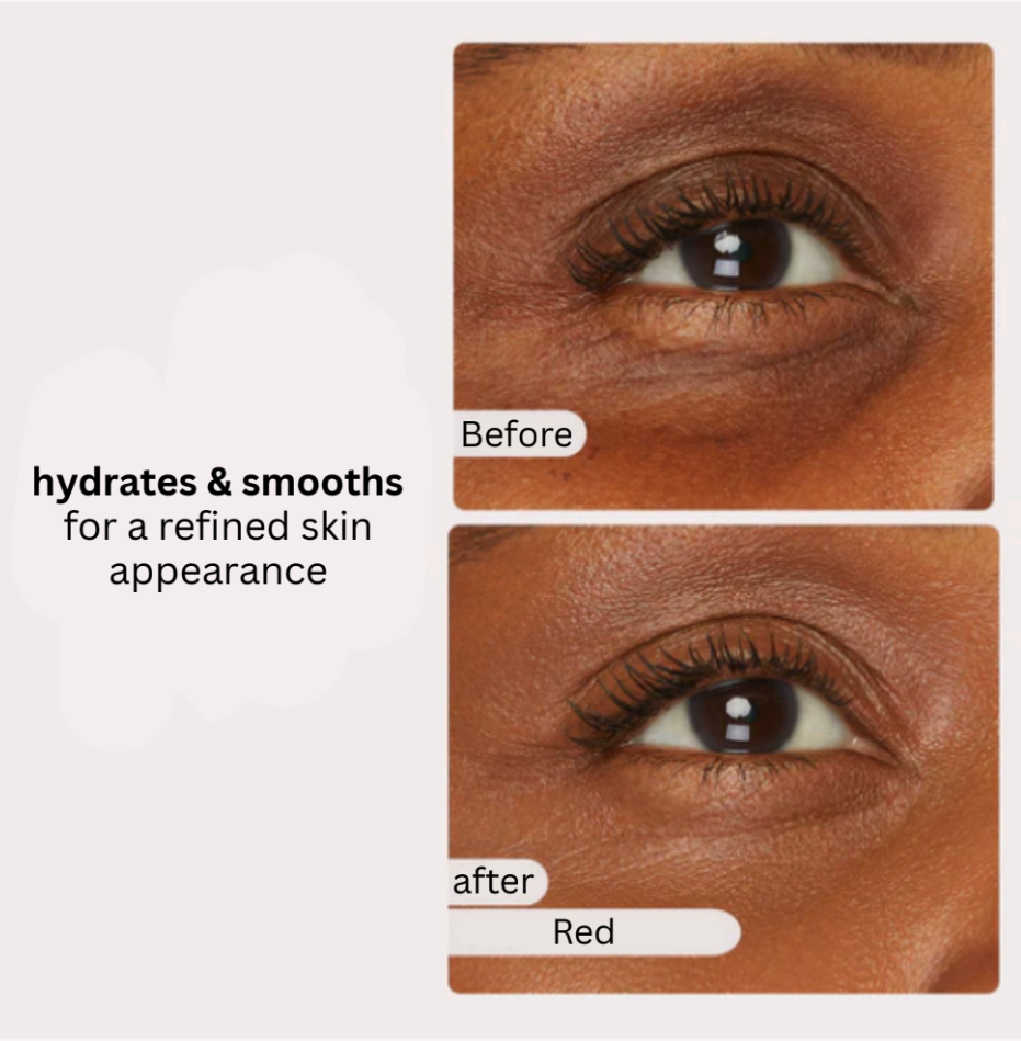 Glowvéa Radiant Under Eye Corrector™